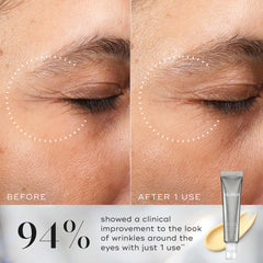 Antes y después Crystal Retinal Ceramide Eye 10