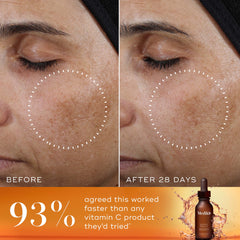 Antes y después Medik8 Super C Ferulic
