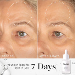 Antes y después Medik8 Liquid Peptides