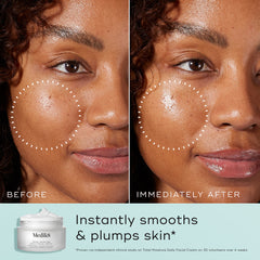 Antes y después Medik8 Total Moisture Daily Facial Cream