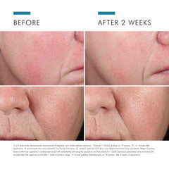 Frasco spray Phyto A+ Essence Mist destapado