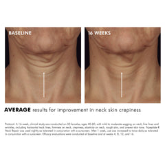 Resultados antes y después con Tripeptide-R en arrugas de cuello