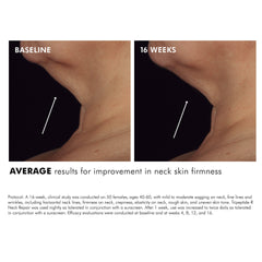 Aplicación de Tripeptide-R Neck Repair en zona del cuello y escote